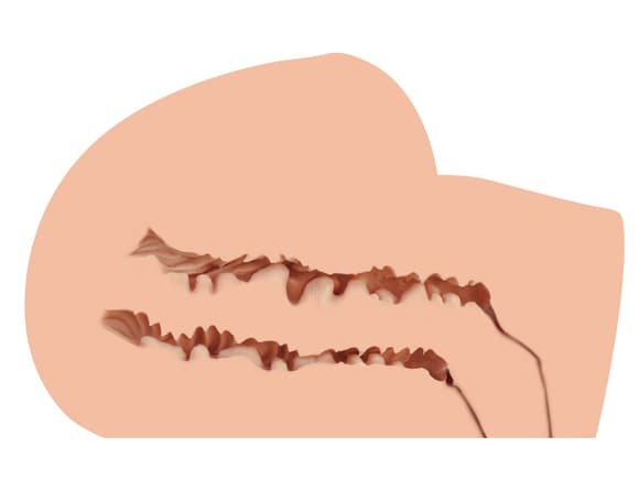 Мастурбатор-полуторс Naked Factory SCARLET, вагина + анус, узкий вход, очень реалистичный, сквозной