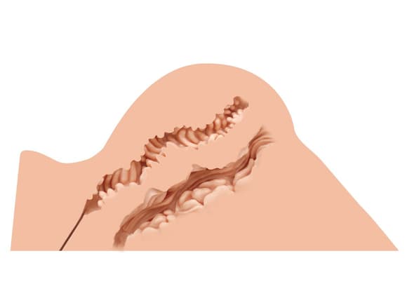 Мастурбатор-попа Naked Factory HANNAH, вагина + анус, очень реалистичный, сквозной